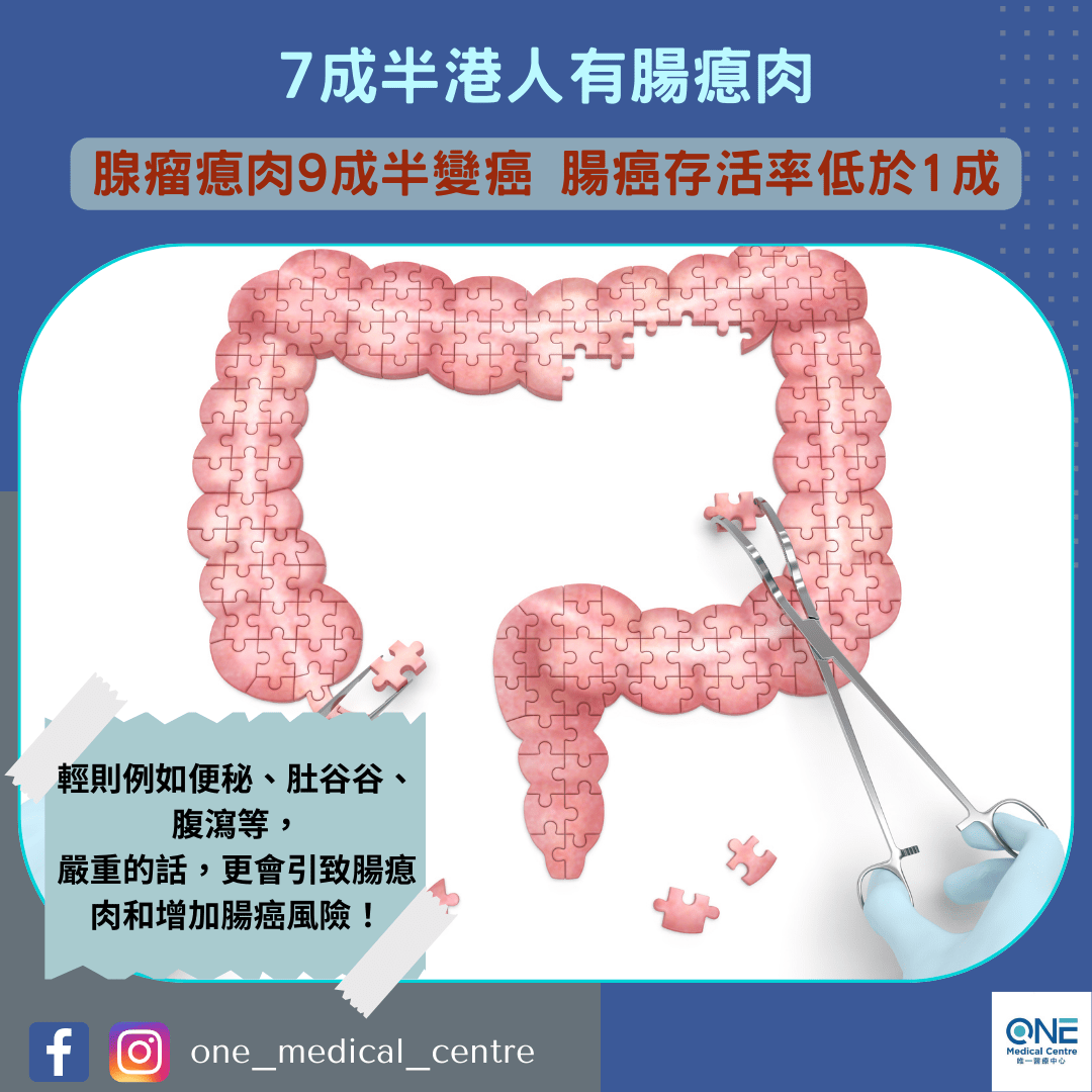 【7成半港人有腸瘜肉　腺瘤瘜肉9成半變癌　腸癌存活率低於1成】